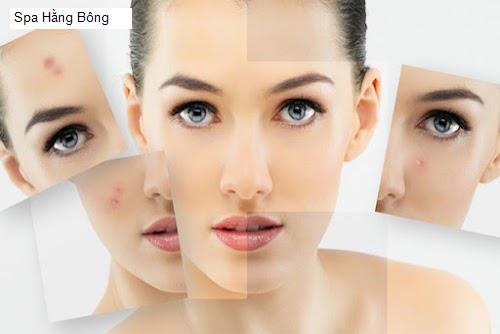 Hình ảnh Spa Hằng Bông