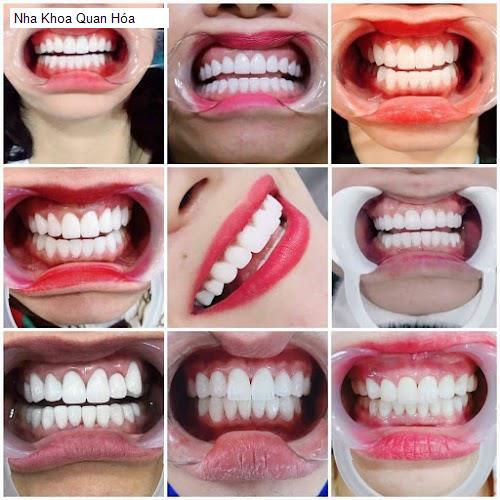Hình ảnh Nha Khoa Quan Hóa